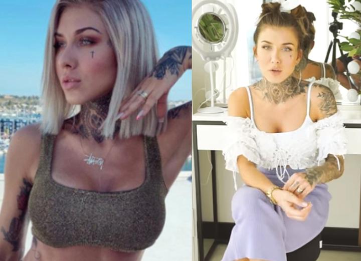 Jakie są implanty 425 ml – odkryj, jaki to rozmiar dla Ciebie