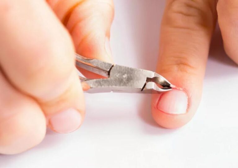 Obcinanie skórek paznokci – kiedy jest konieczne i jak to robić właściwie?
